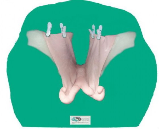 Sada patologick&yacute;ch děloh (teriogenologie)